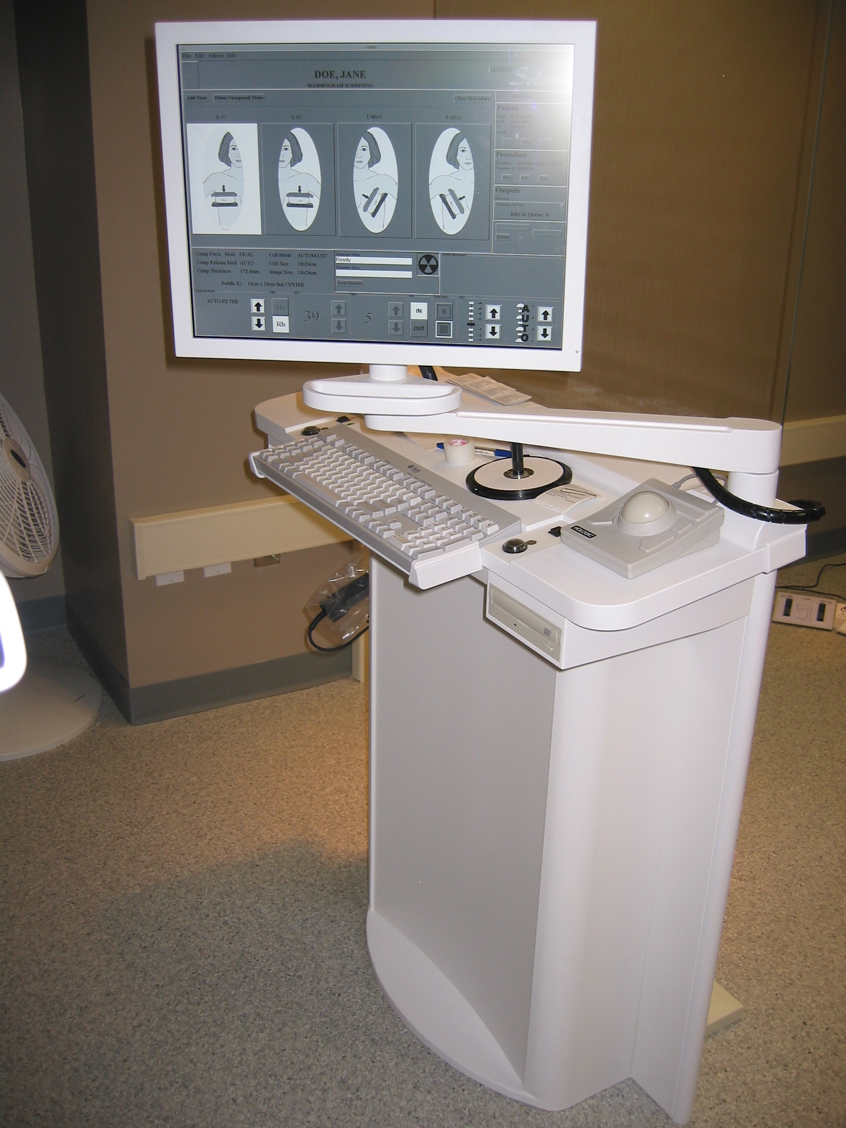 Mammography Workstation